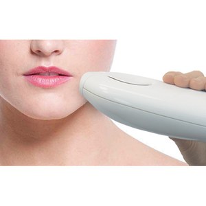 Iluminage 便携款激光*仪 $220.75（约1599元）