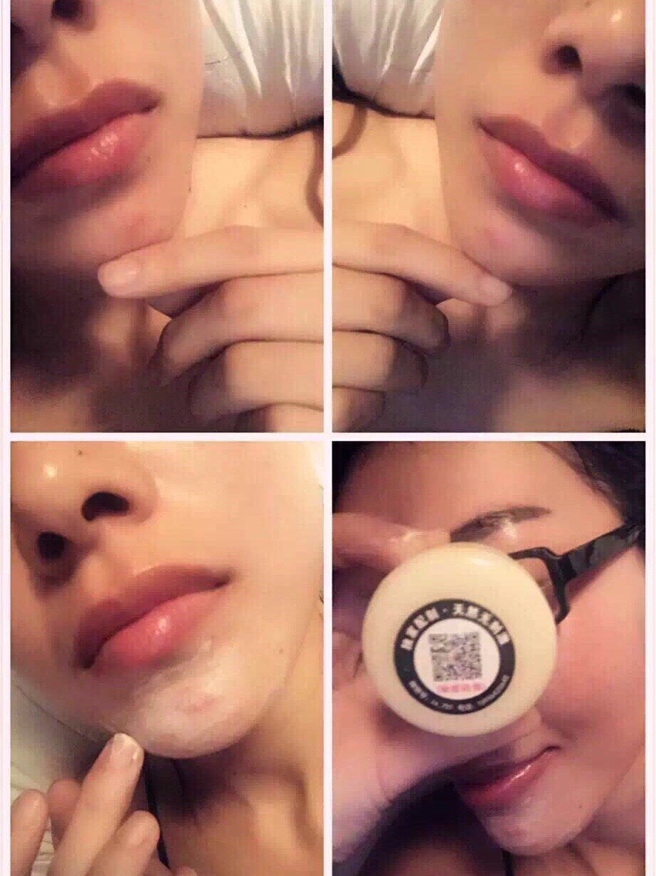 我是属于一到暖季不停的冒痘的皮肤，因为是混油性➕肌🙄，夏季