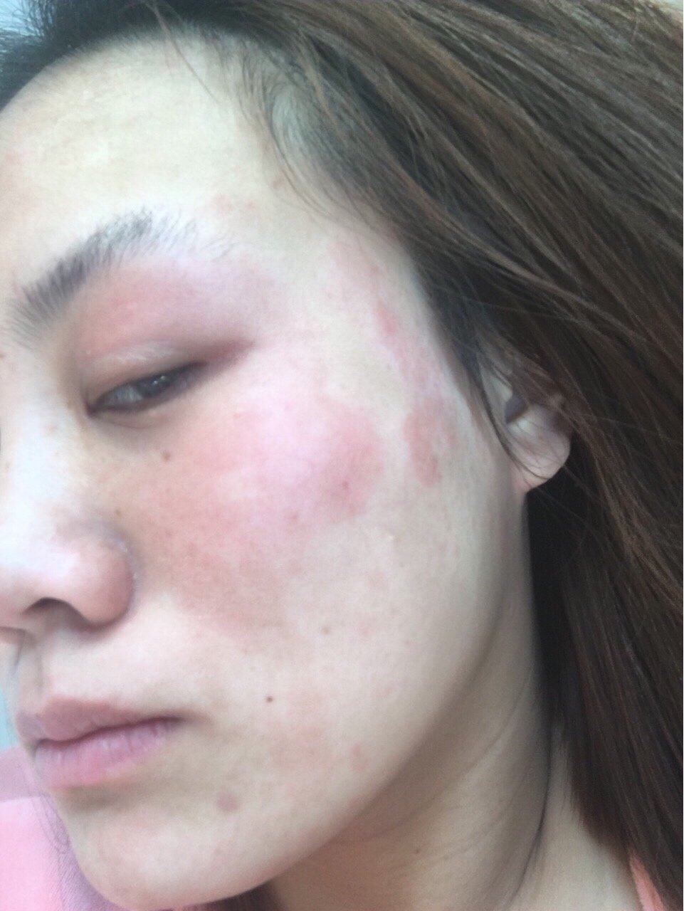 女孩儿👧最关心的面部护肤心得—改造肌肤！ 之前用过一个明星