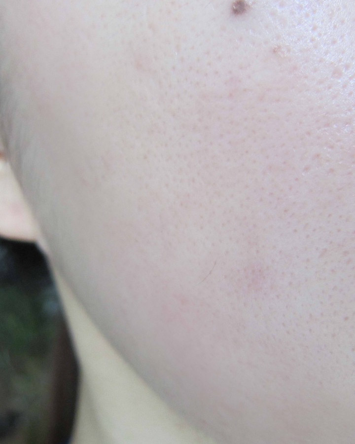 贝茗粉底液💖💖💖 色号：03 夸赞过无数次的！祛痘！粉