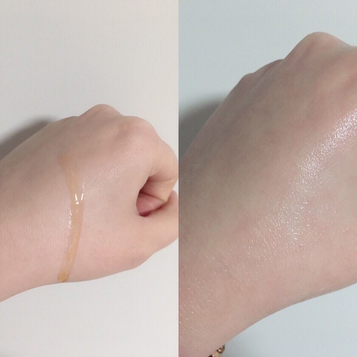 林允同款抗老精华❗️用对了就是熬夜神器💓修仙救星🌟 之前