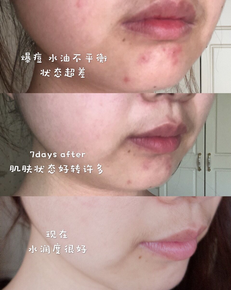 HR赫莲娜明星产品绿宝瓶系列测评👒 大名鼎鼎的HR赫莲娜绿