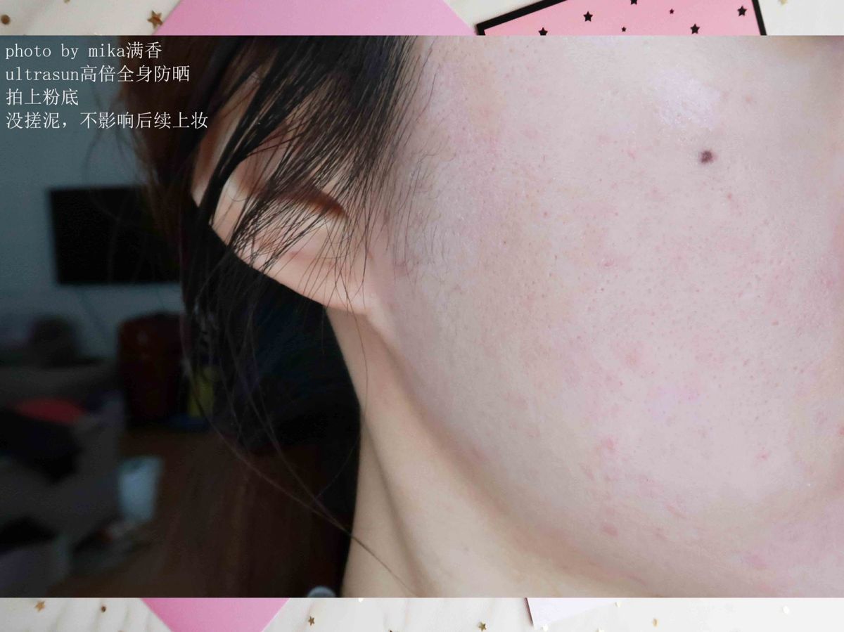 ultrasun高倍全身霜💖💖💖 暑假马上就要结束啦，