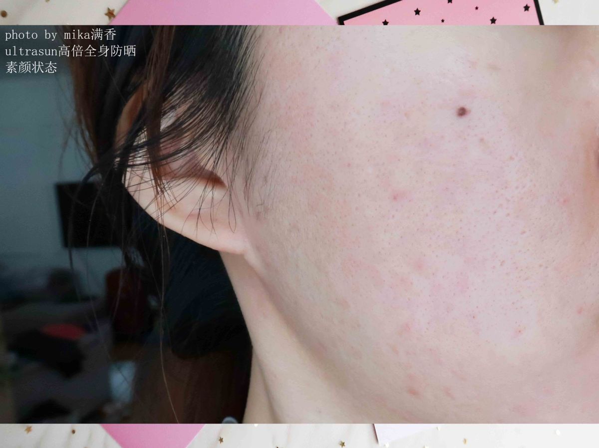ultrasun高倍全身霜💖💖💖 暑假马上就要结束啦，