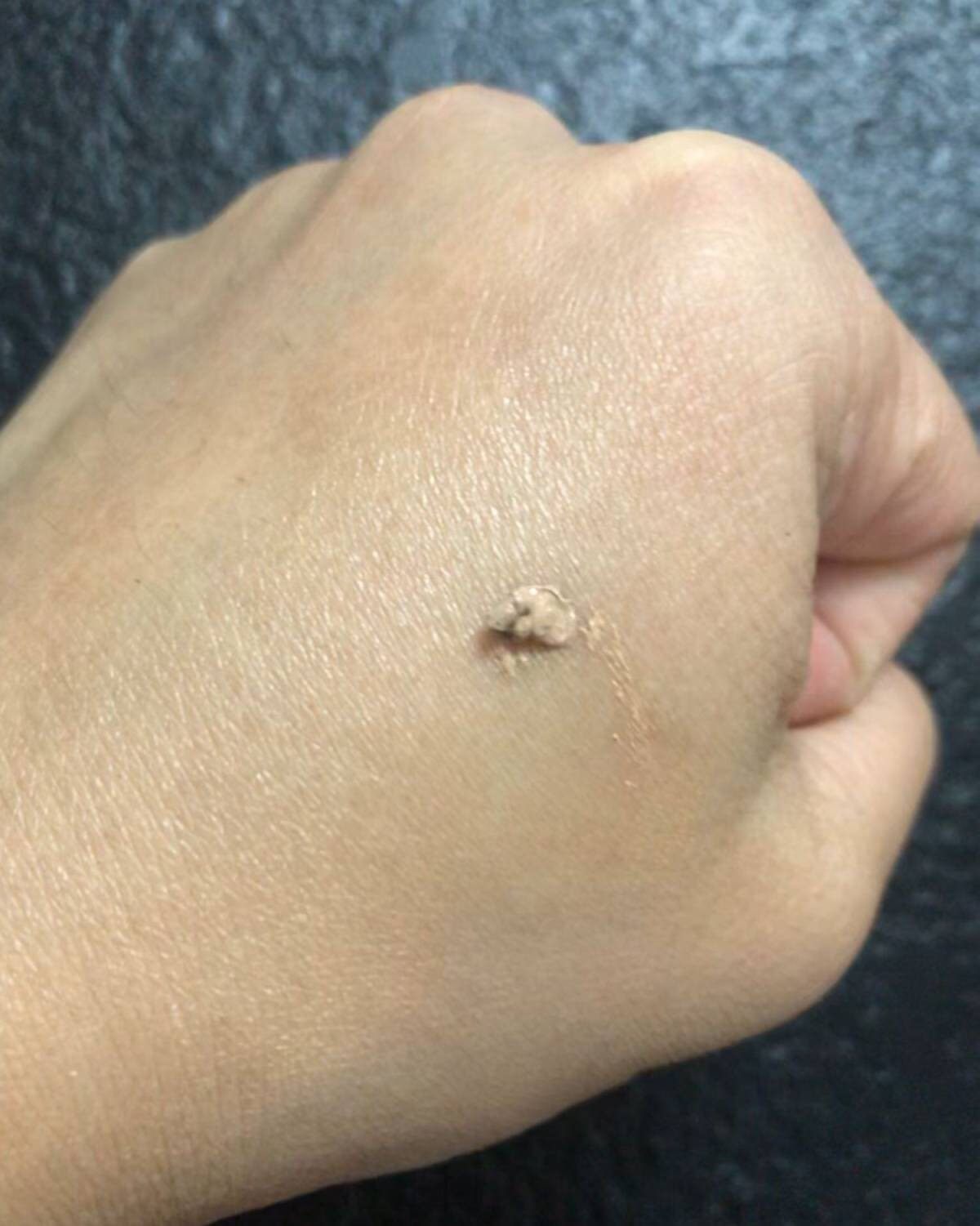 🎏🎏murad是美国品牌，之前买了很多的，是他家的清痘系