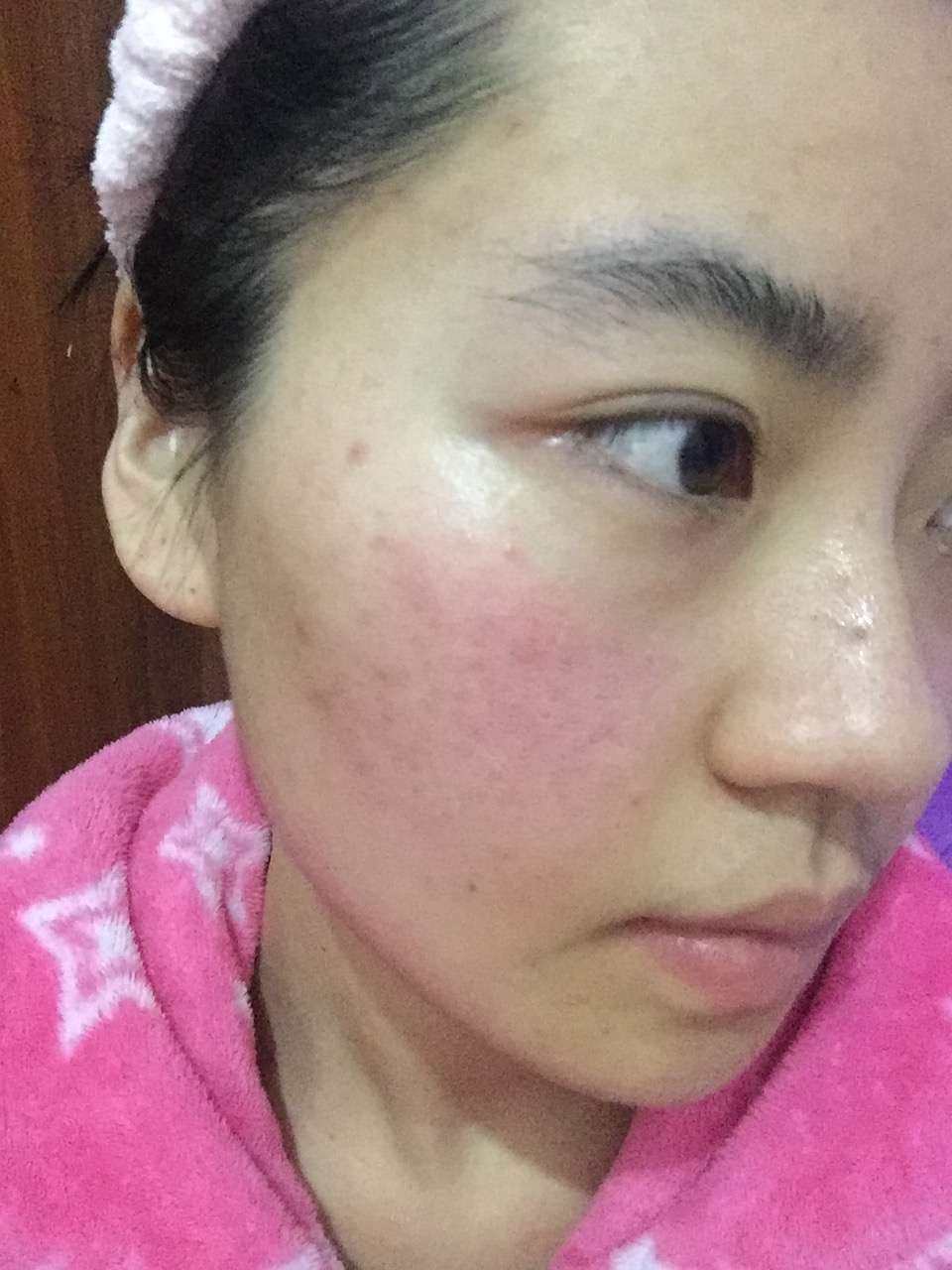 TRI STOP X射频美容仪 在skinstore上买的，