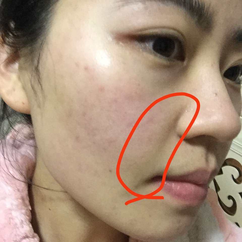 TRI STOP X射频美容仪 在skinstore上买的，
