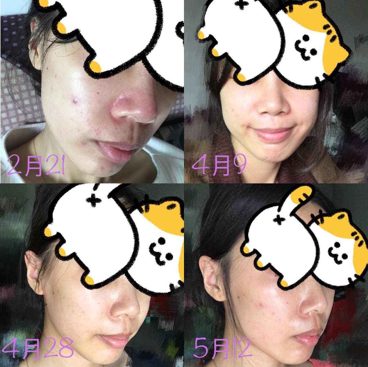 😣期一定要用雅诗兰黛小棕瓶呀!!!!(喊破喉咙) ps：我