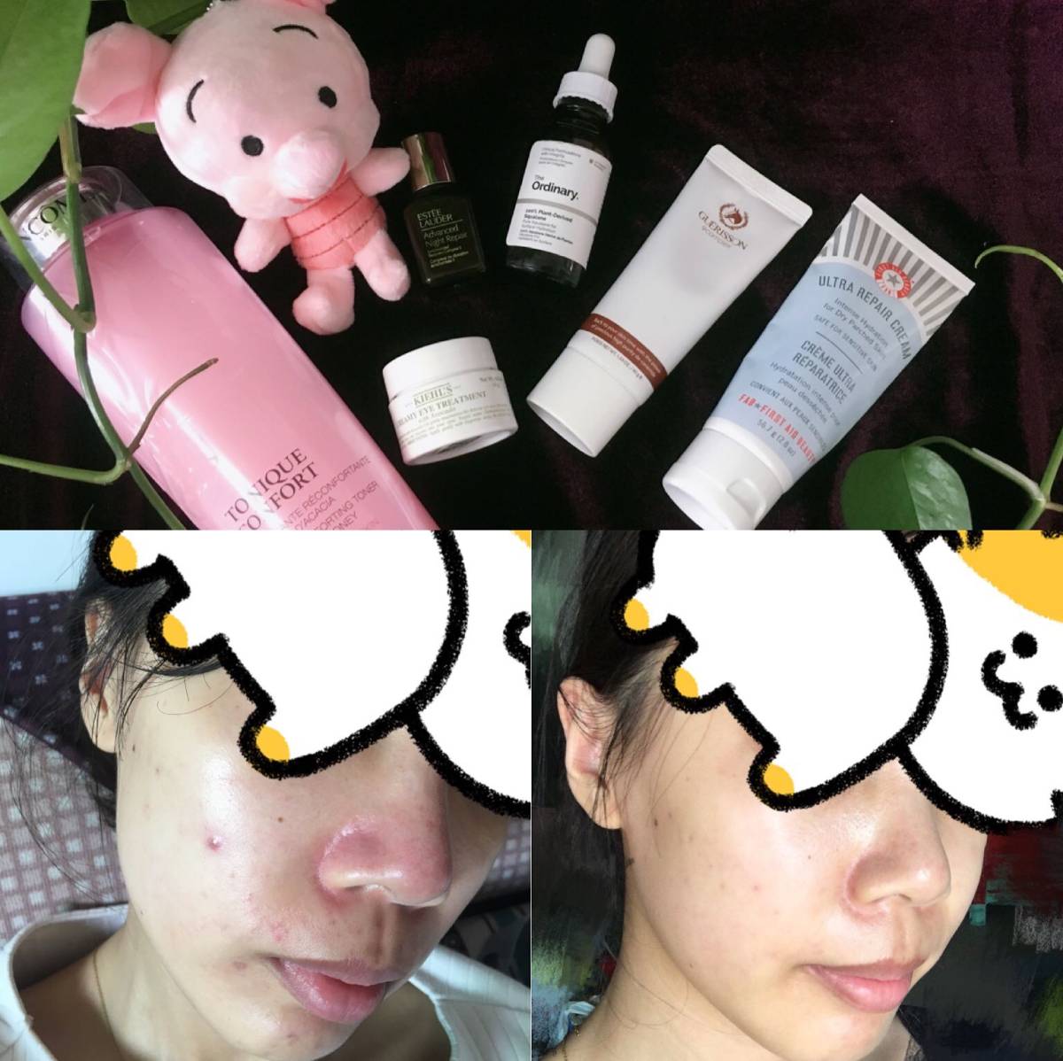 😣期一定要用雅诗兰黛小棕瓶呀!!!!(喊破喉咙) ps：我