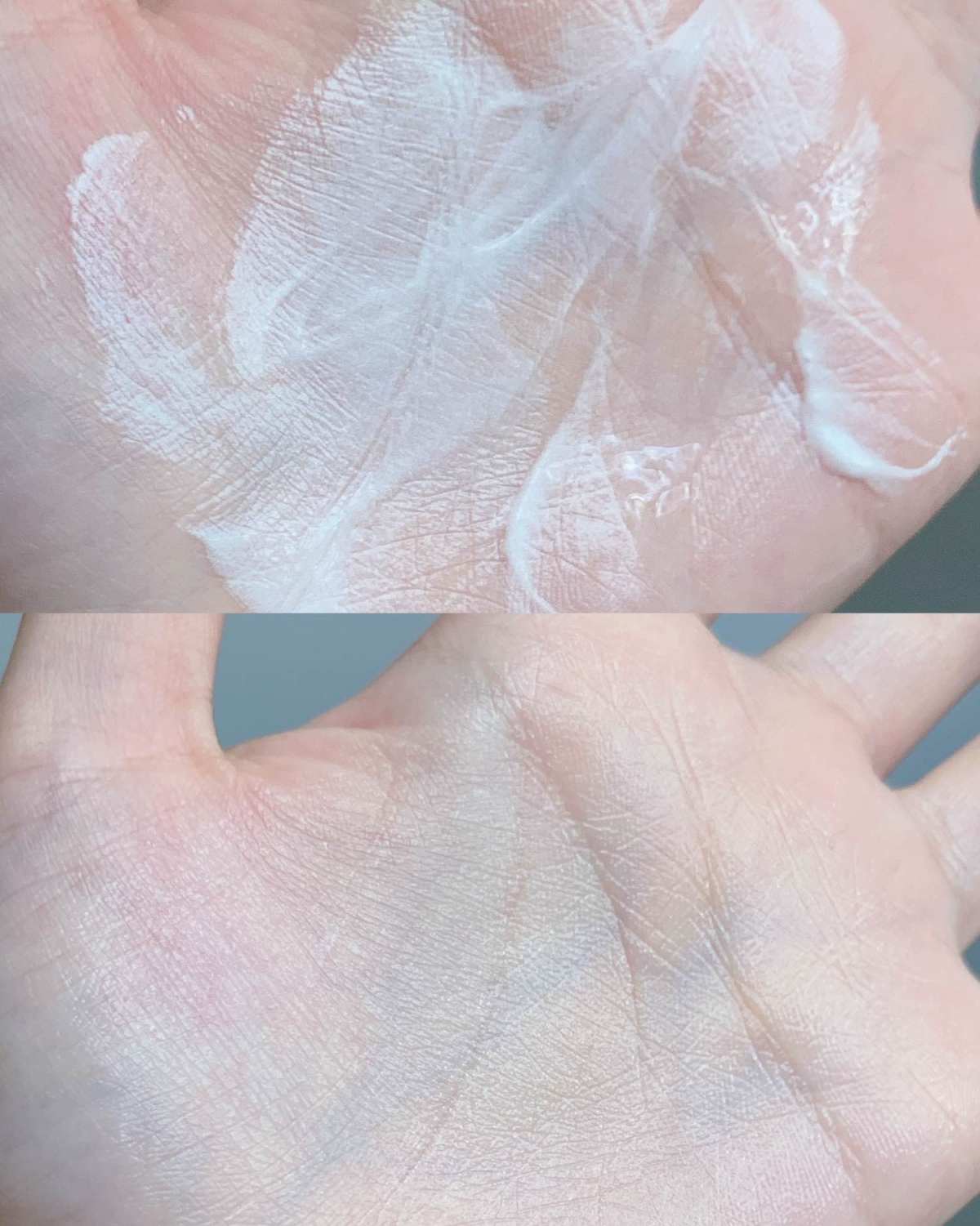 换季 蜕皮 长痘痘等等烂脸的时候一定要用它！！简直是救星！！