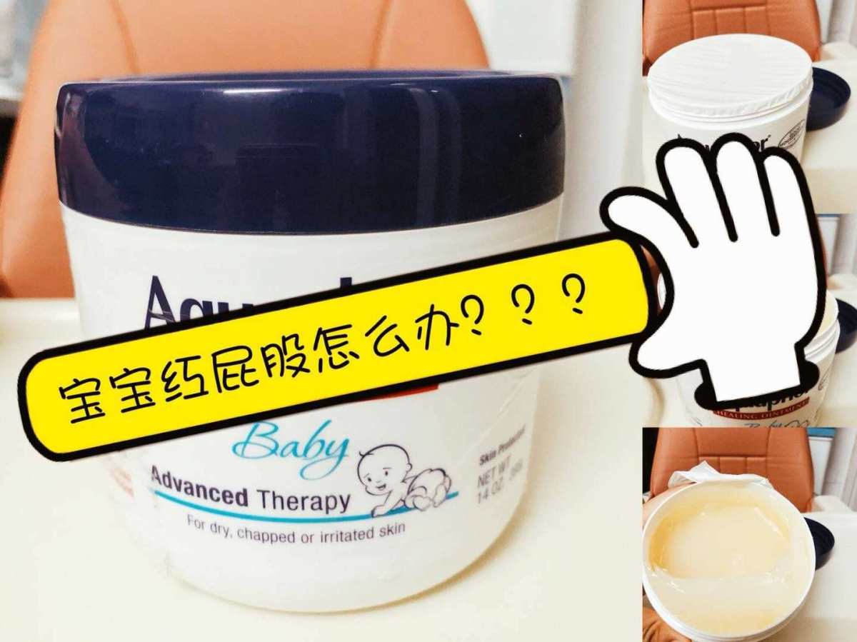 今天就来介绍一下超好用的Aquaphor，都给我买起来!  