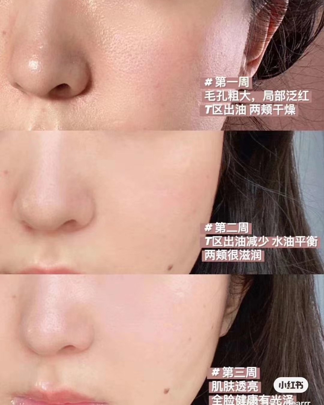 菲洛嘉粉水（需要直接私我）      💰298  干皮梦寐