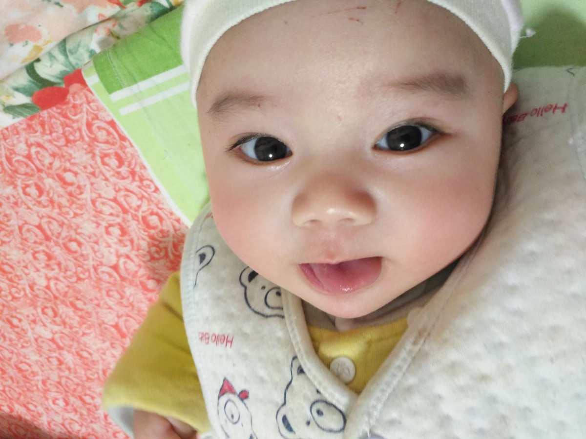 最美笑脸绽放六一，响应活动号召，来晒一晒 图一是之前2个月肺