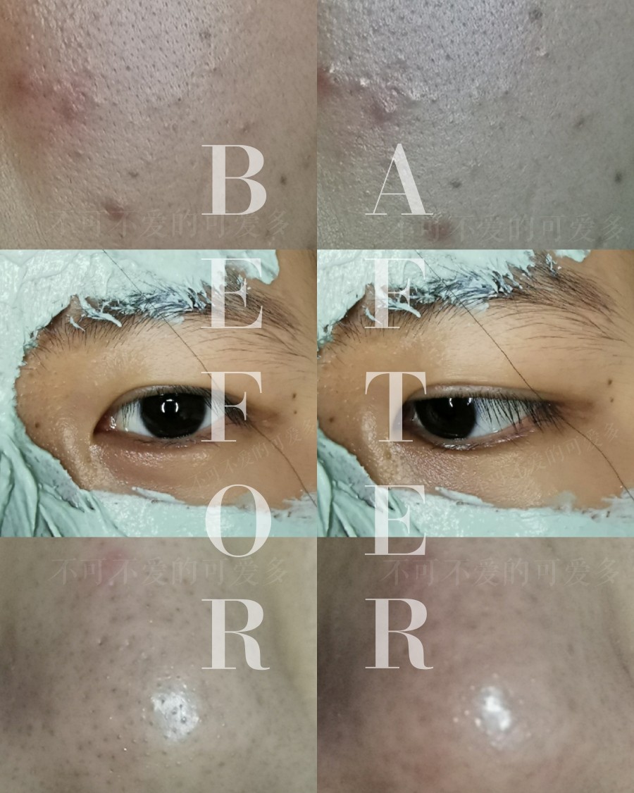 AA网清洁面膜 功效当然是清洁啦 是有颗粒状的 反正按照说明