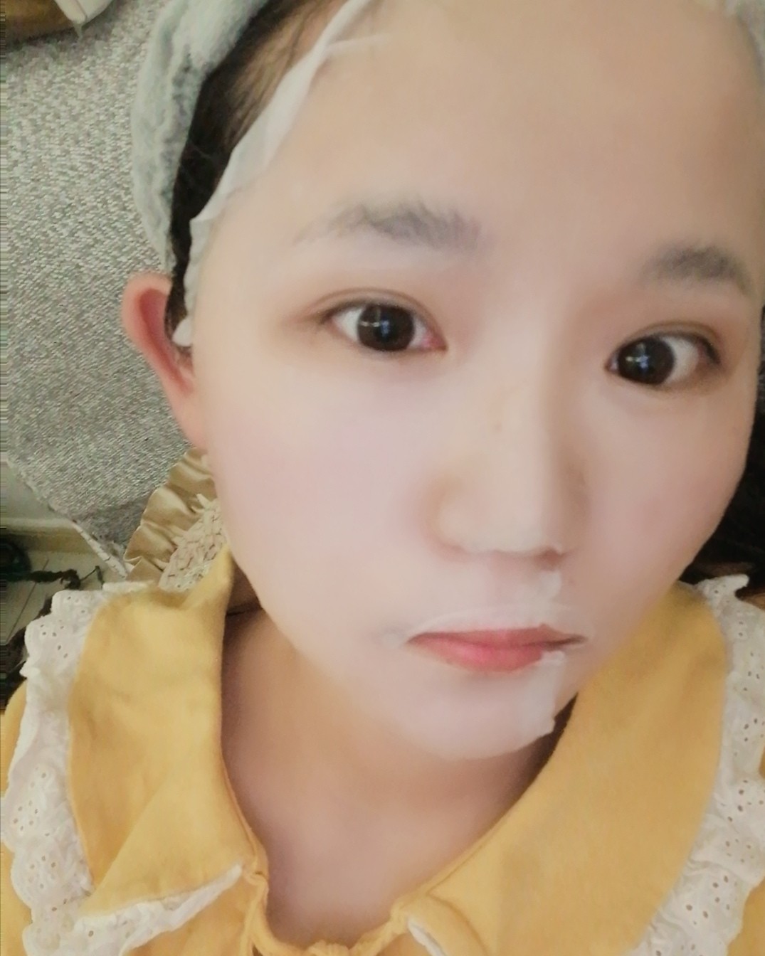 敷尔佳  械字号用透明质酸钠修复贴        之前风很大