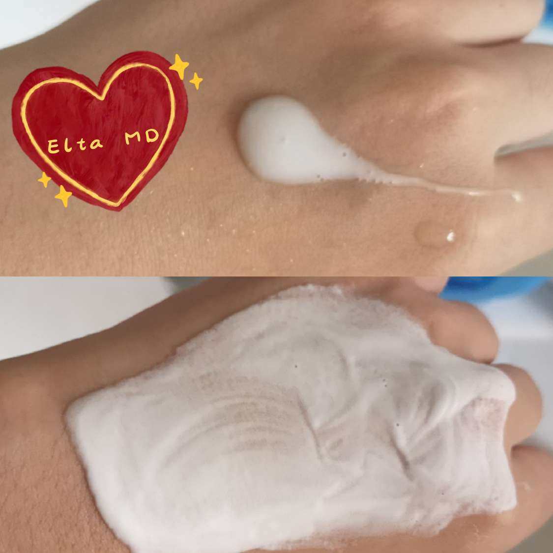 洗面奶红黑榜分享🌸 红榜——Elta MD家的洗面奶 一年