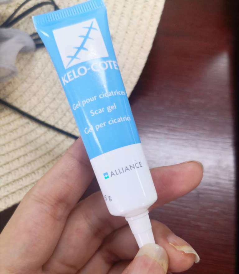 🌟祛除疤痕好物:芭克 Kelo-cote 受怎么办？手术怕