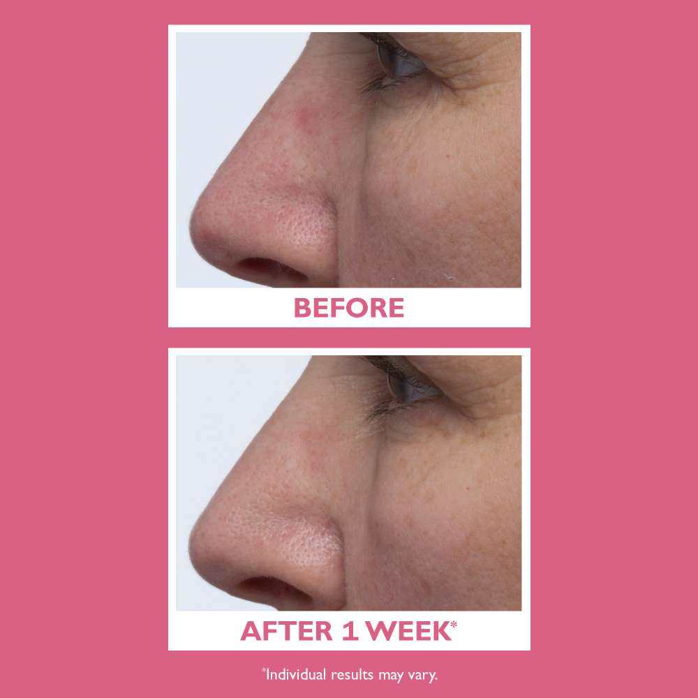 产品评测之彼得罗夫VE面霜  一、购买渠道   必然是[彼得