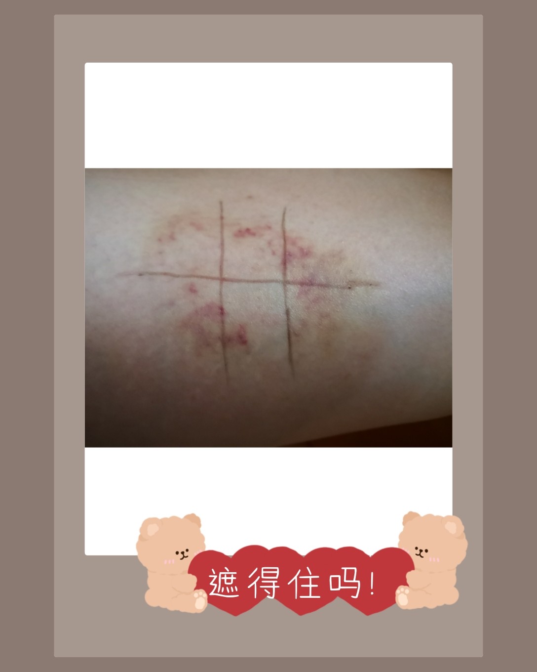 遮暇测评！！是否可以遮住这个？？ ♥图三是我腿上的，其实前两