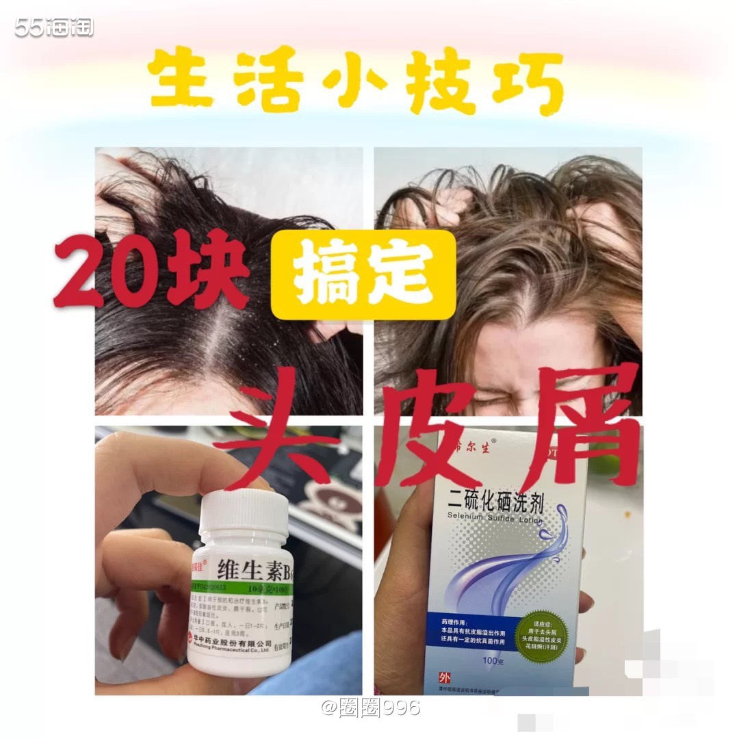 看到标题大家可能疑惑：这不是说发吗？和头皮屑有什么关系？ 溢