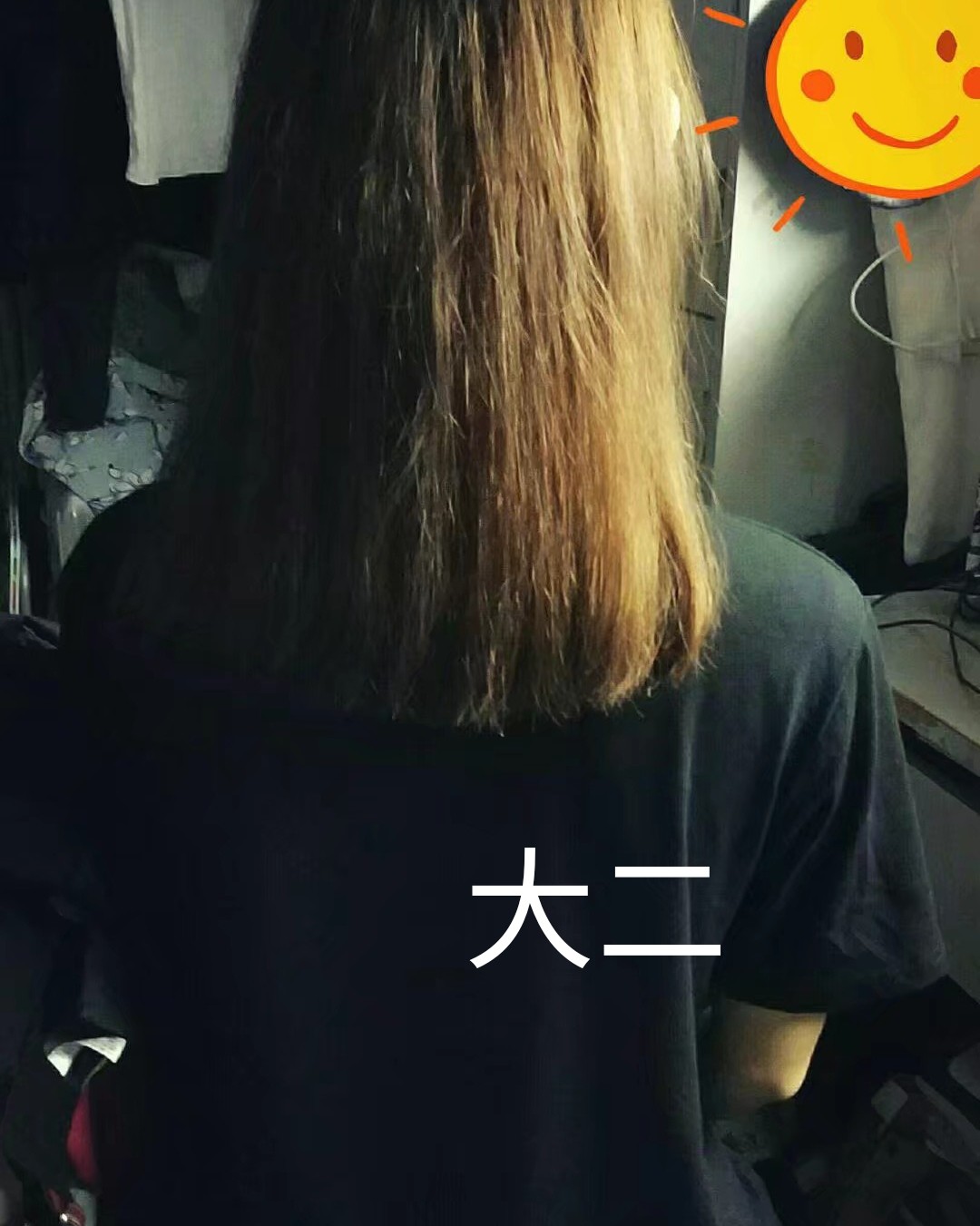 如何改善头发生长缓慢？ 我的头发天生少+发际线越来越高🤣 