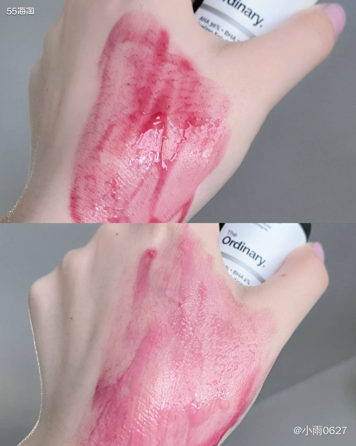 🍎the ordinary 果酸面膜 这个真的神了！我额头