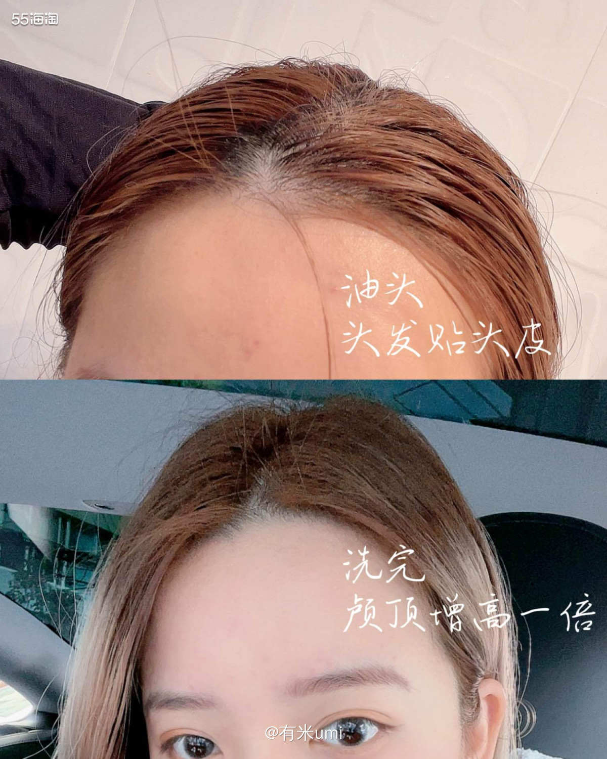 颅顶瞬间增高一倍｜只需选对洗发水   ▪是不是很多宝宝都有油