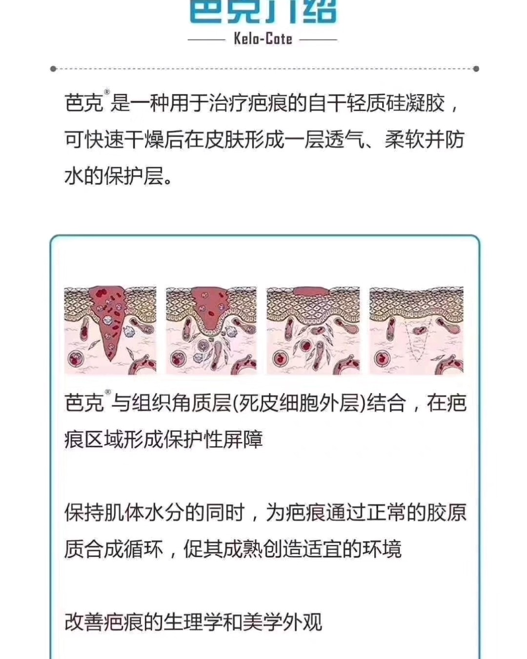 祛疤界的扛把子———亚马逊海外购巴克祛疤膏 亚马逊曾经也是很