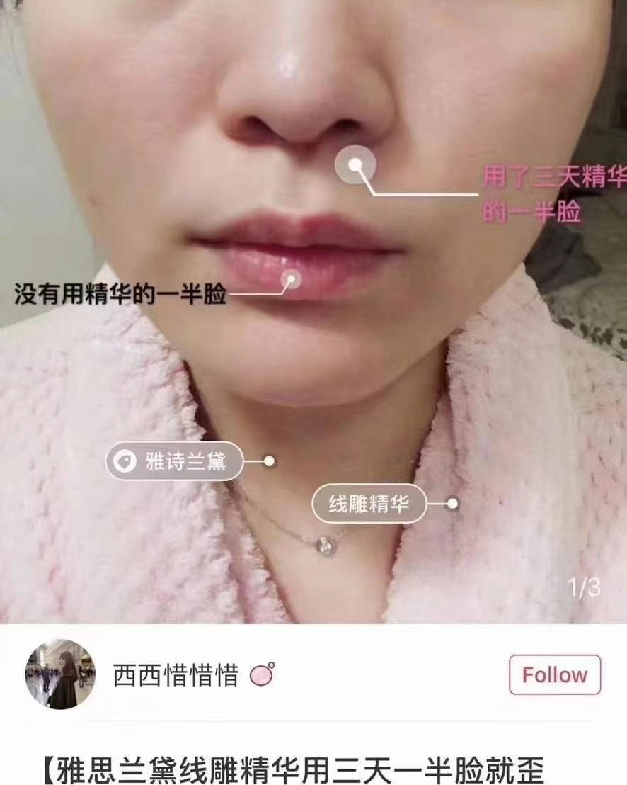 **级别的❗️美版❗️ 雅诗兰黛线雕精华50ml双瓶套装，¥