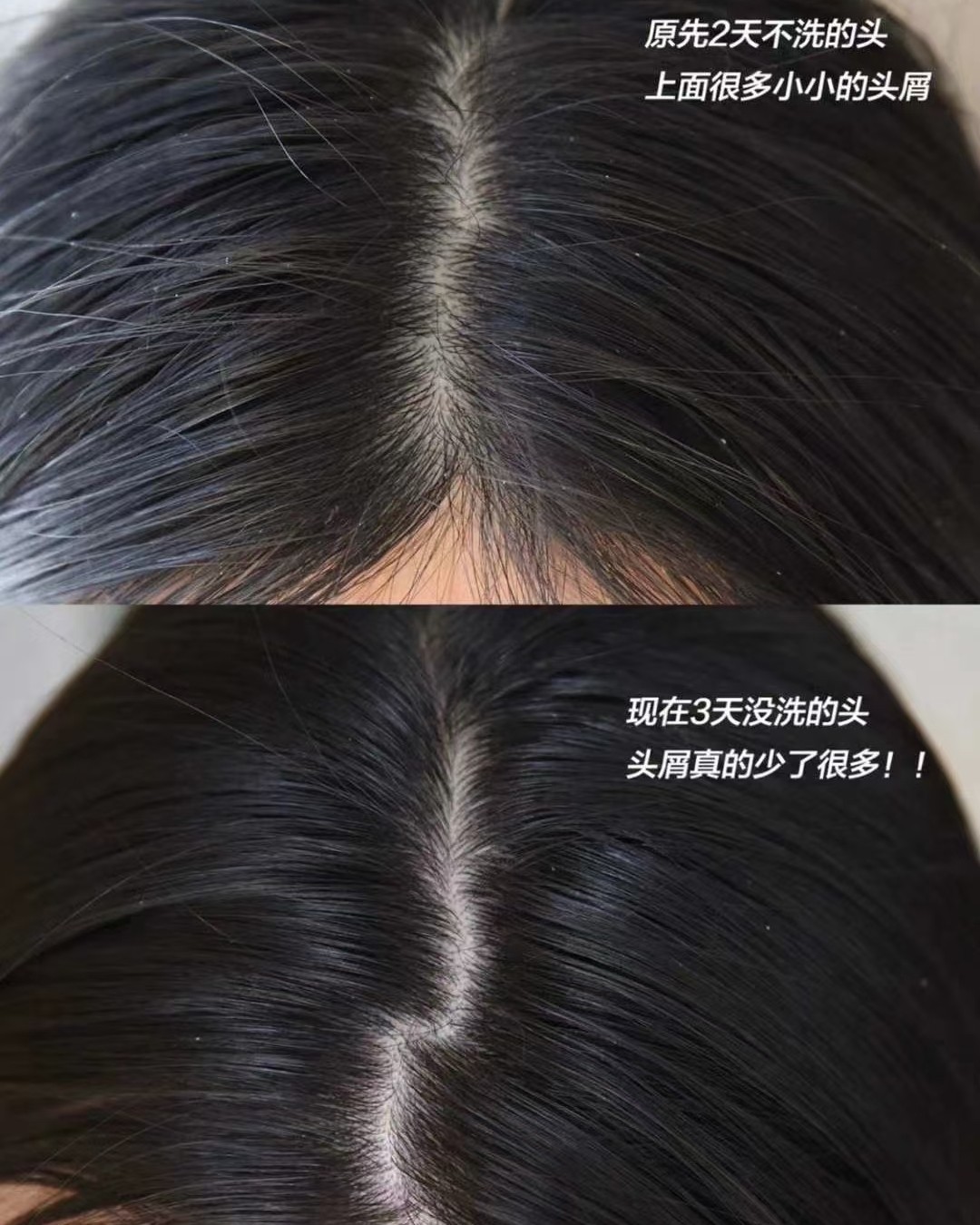 💌科丽尼青蒿头皮素  自用，真心好用‭‮油👏👏👏 头