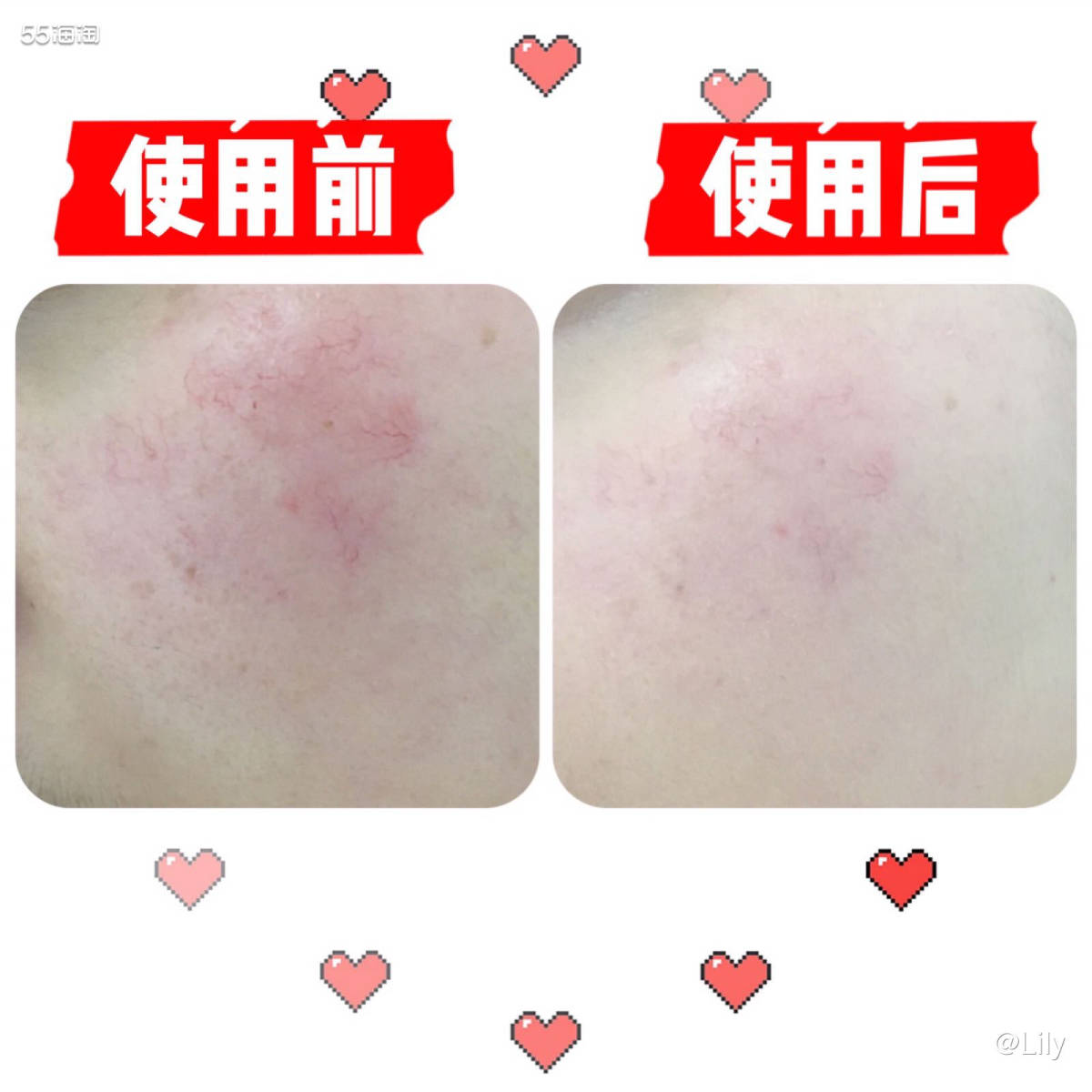 这是我第二次获得Beautinow的试用福利，非常感谢55小