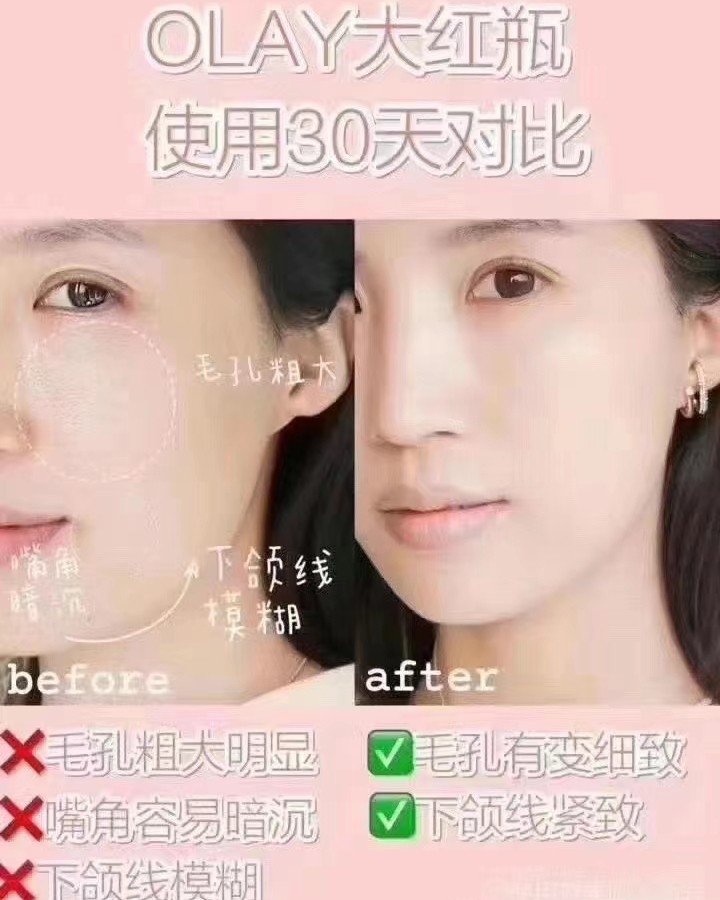 史低价，美版Olay玉兰油大红瓶 ，含有lamer和sk2面
