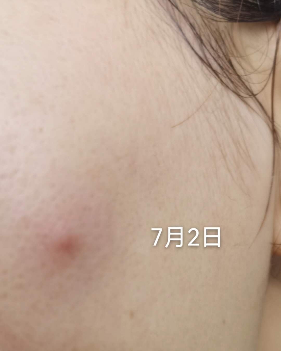 刷酸风大，大球也沉浸刷酸很久了~一个是宝拉珍选一个是博乐达水