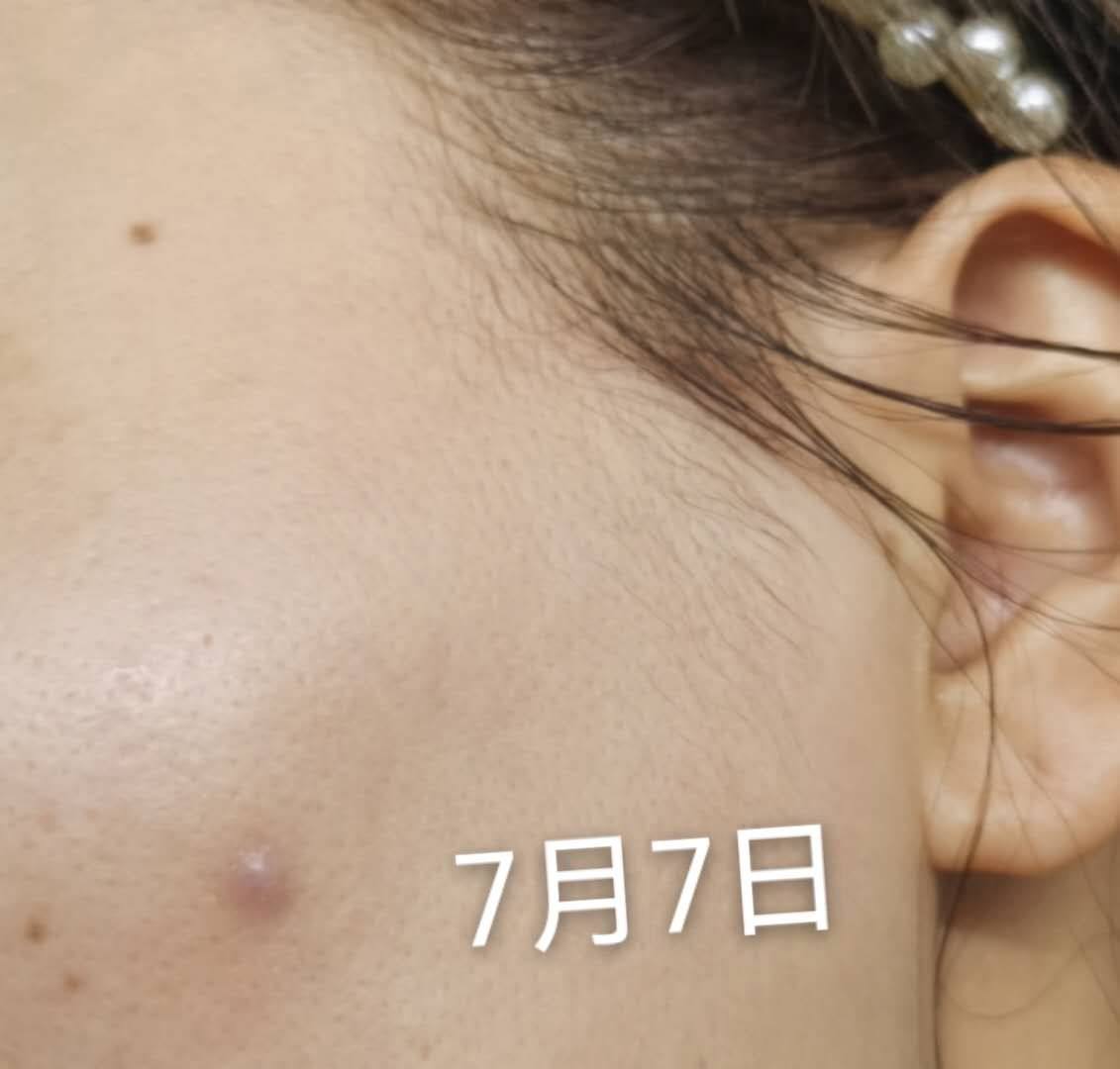 刷酸风大，大球也沉浸刷酸很久了~一个是宝拉珍选一个是博乐达水