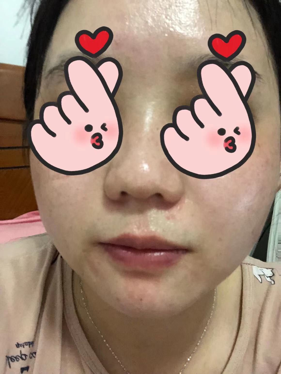 这个fres红茶面膜-黑罐现在我的新宠，我的皮肤在夏天的时候