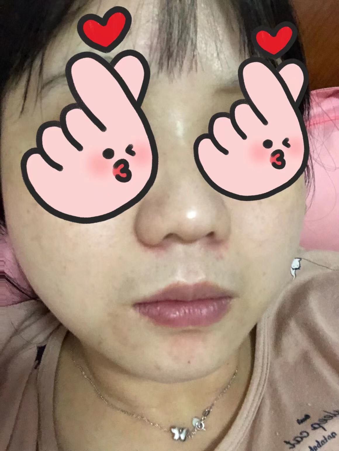 这个fres红茶面膜-黑罐现在我的新宠，我的皮肤在夏天的时候