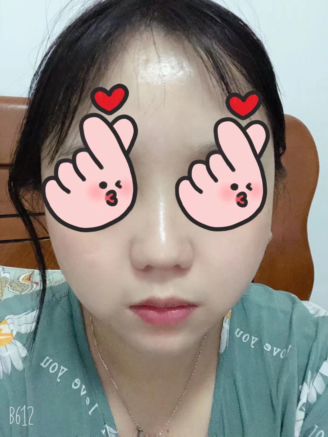 丸美蝴蝶眼膜贴  ✅这个眼膜贴当时在某直播间购入，直播的时候