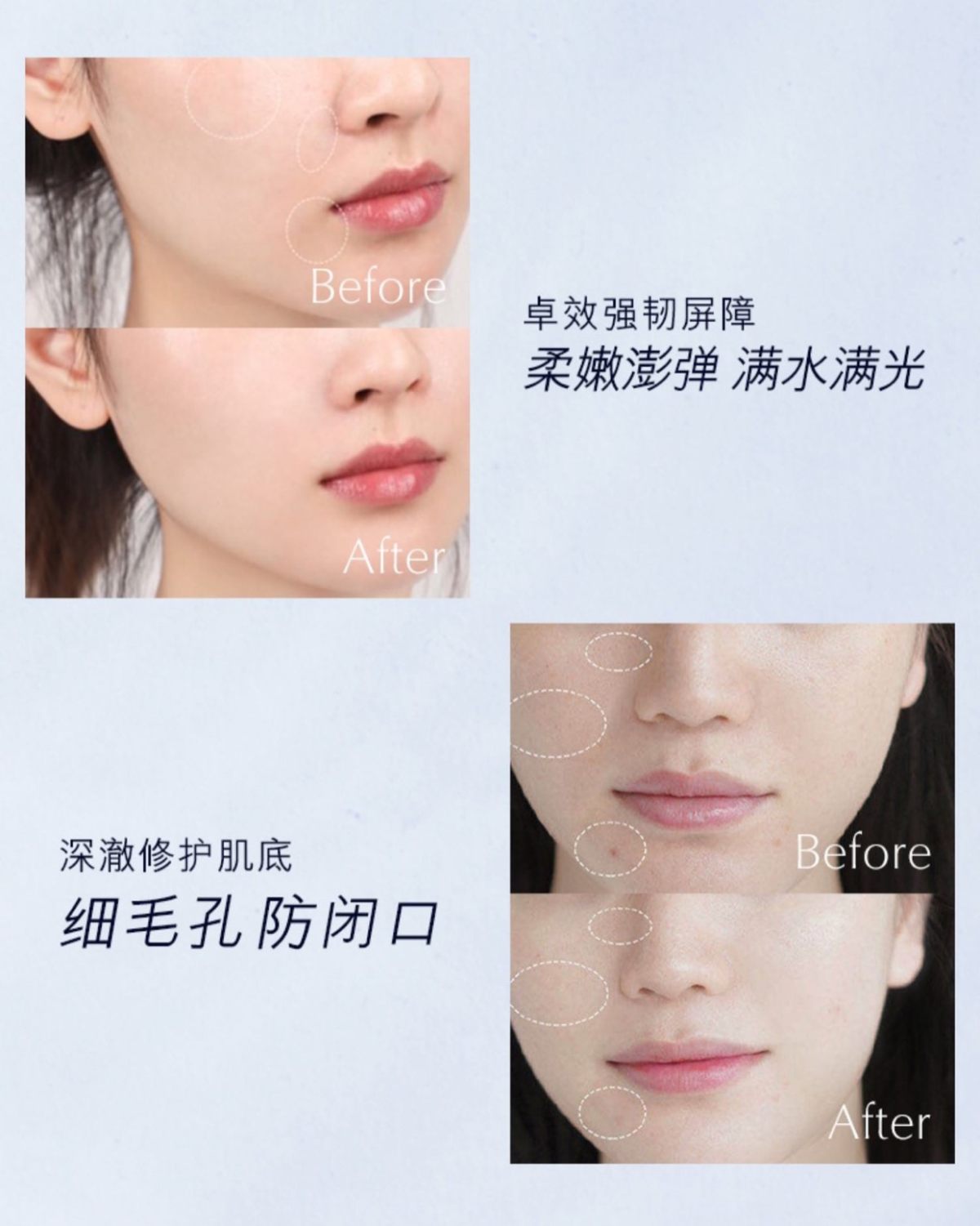 雅诗兰黛原生液 号称干皮神仙水 我看官网po的图真的被种草了