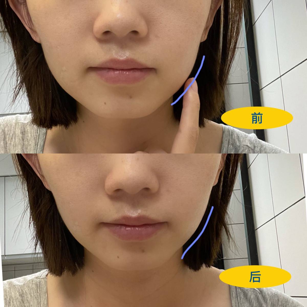 入手Nuface mini已经有一年多了 算是目前使用率比较