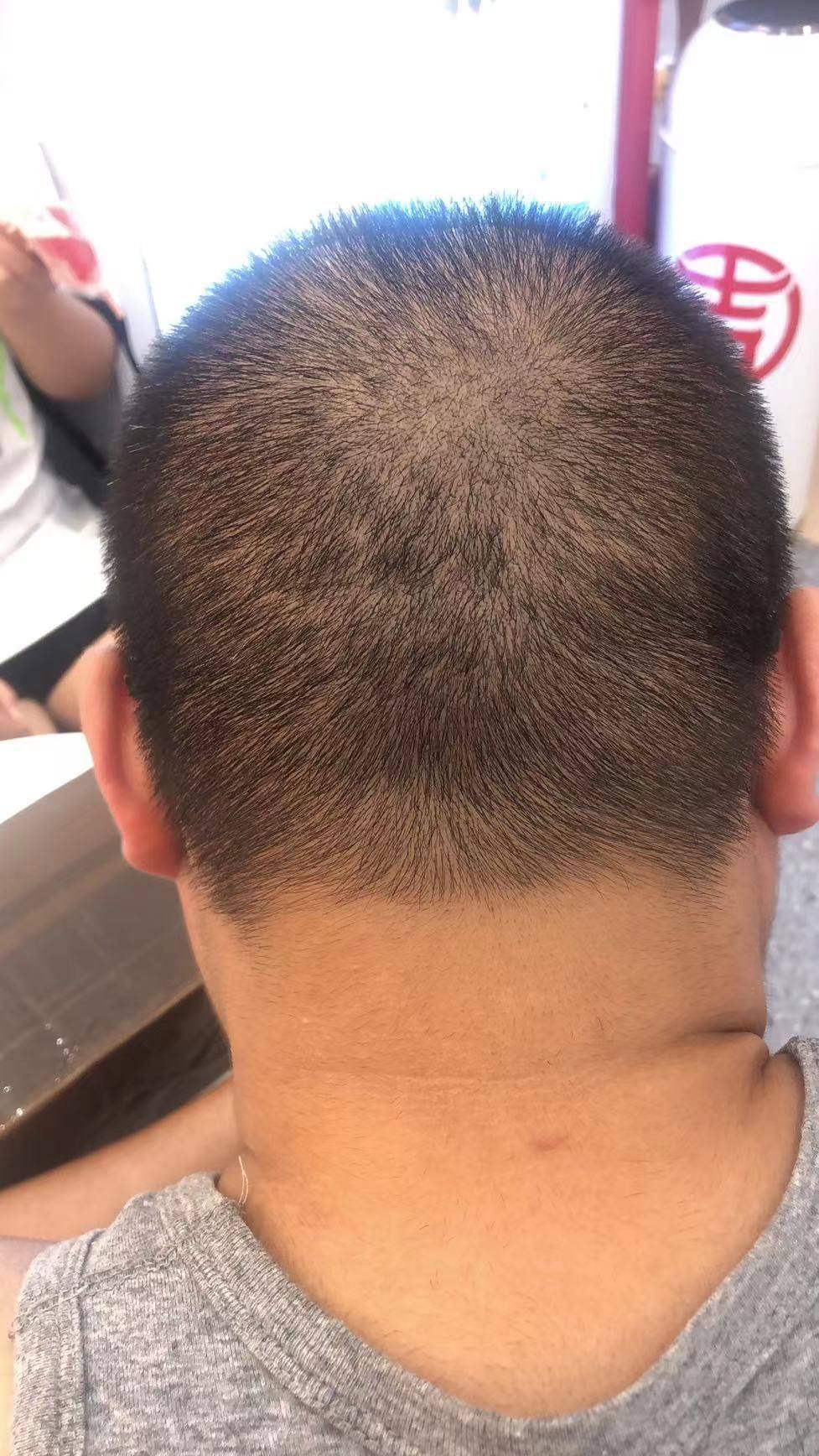 ✅GG液当时在群里被小伙伴种草，早就想试效果了，老公是程序员