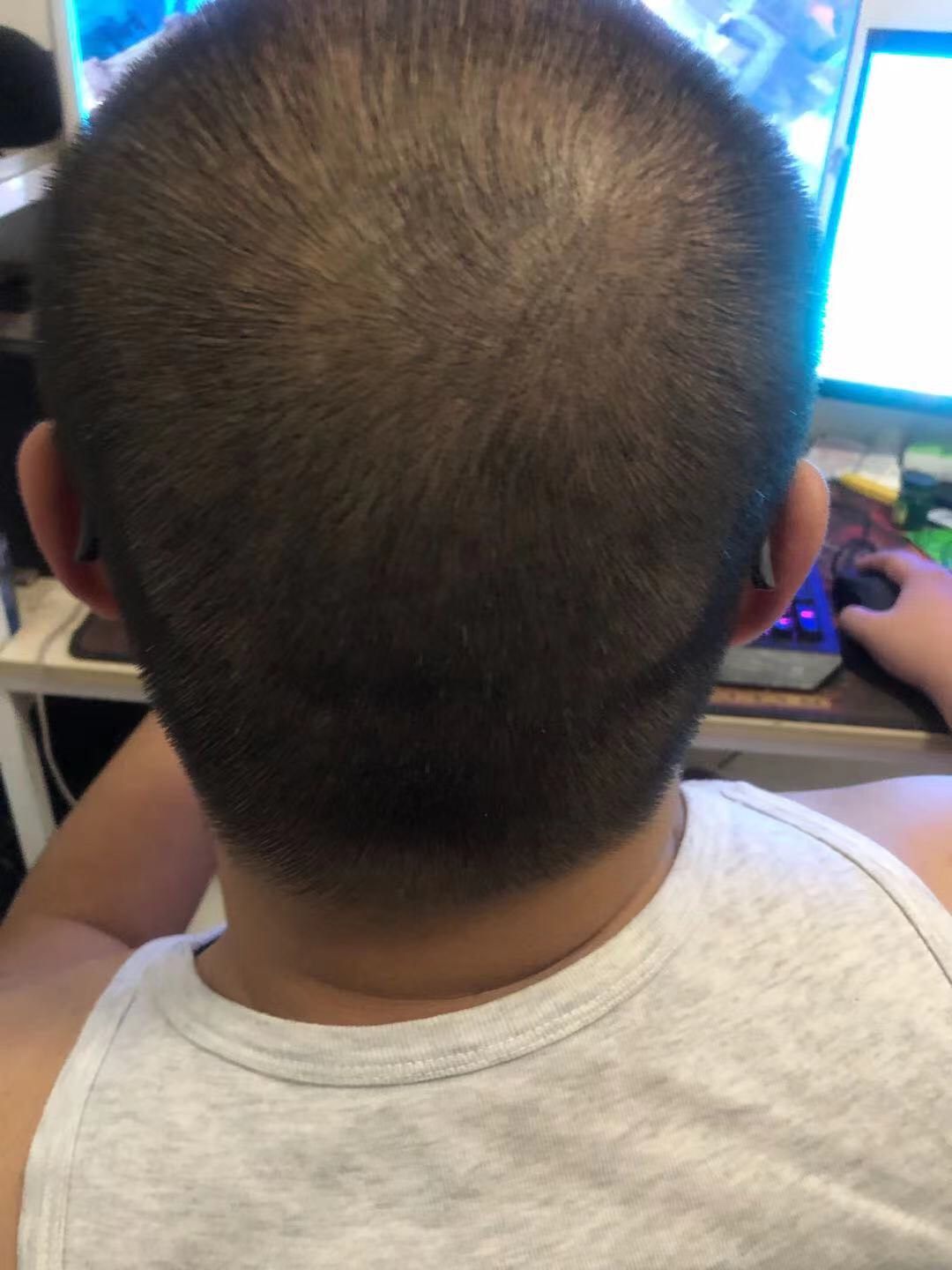 ✅GG液当时在群里被小伙伴种草，早就想试效果了，老公是程序员