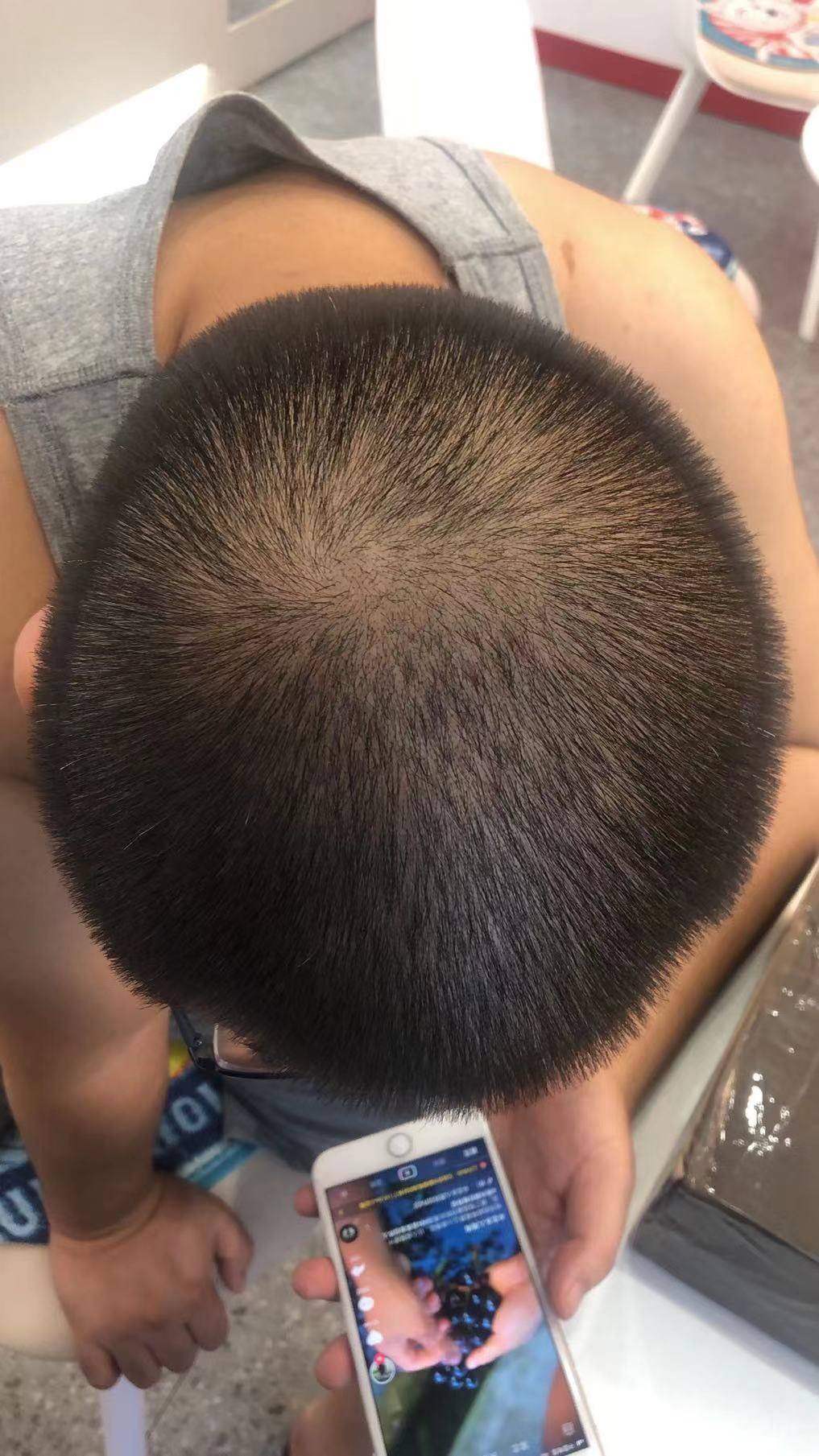 ✅GG液当时在群里被小伙伴种草，早就想试效果了，老公是程序员