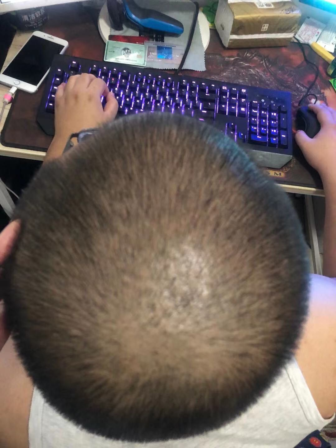 ✅GG液当时在群里被小伙伴种草，早就想试效果了，老公是程序员