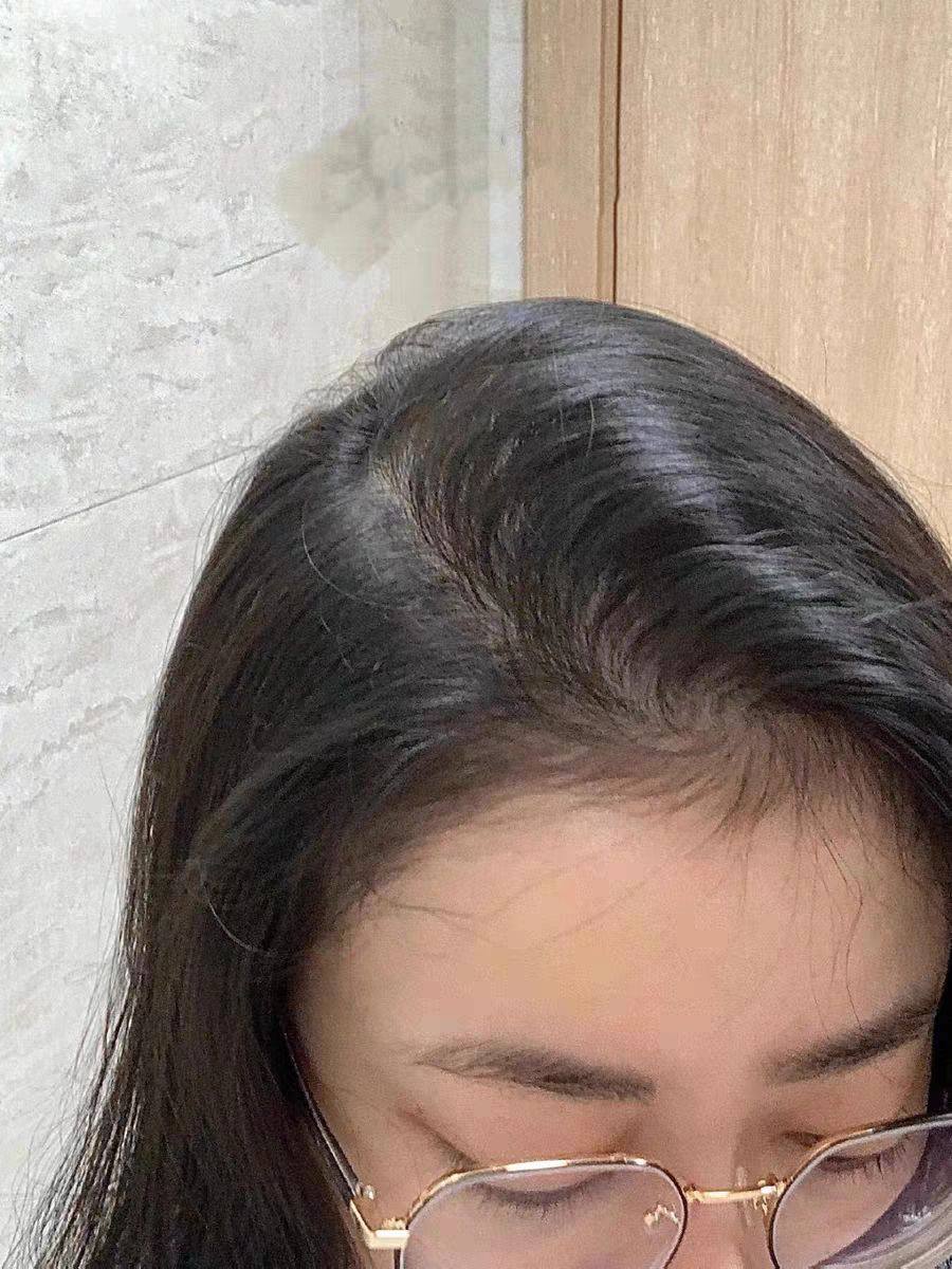 这两年脱发越来越严重了，我身边的损友也老爱刺激我，为了显头发