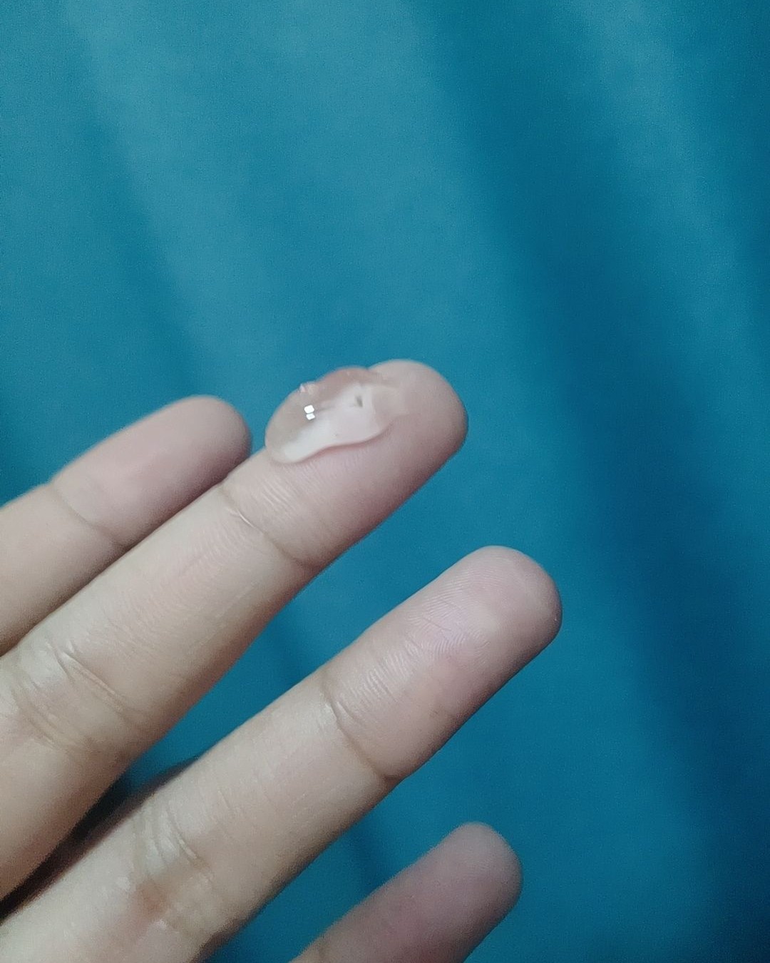博乐达我在社区写过几次了，真的好用，祛痘去闭口细腻皮肤选它！