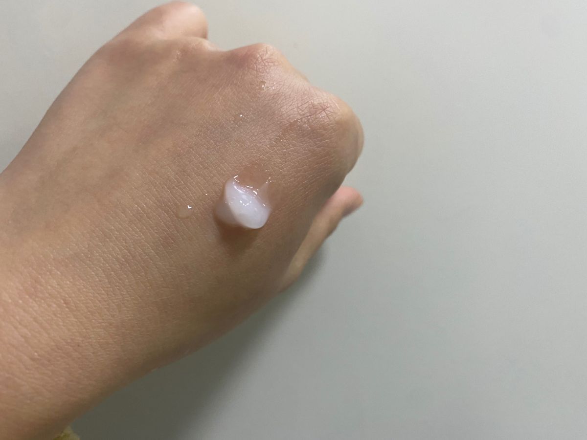 ✔️一款效果很明显的闭口粉刺救星：阿X帕林凝胶  ⭐️话说年