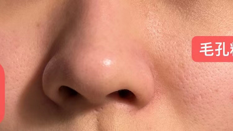 这几种产品搭配起来用，拯救你的科颜氏白泥！ 想看效果可以看后