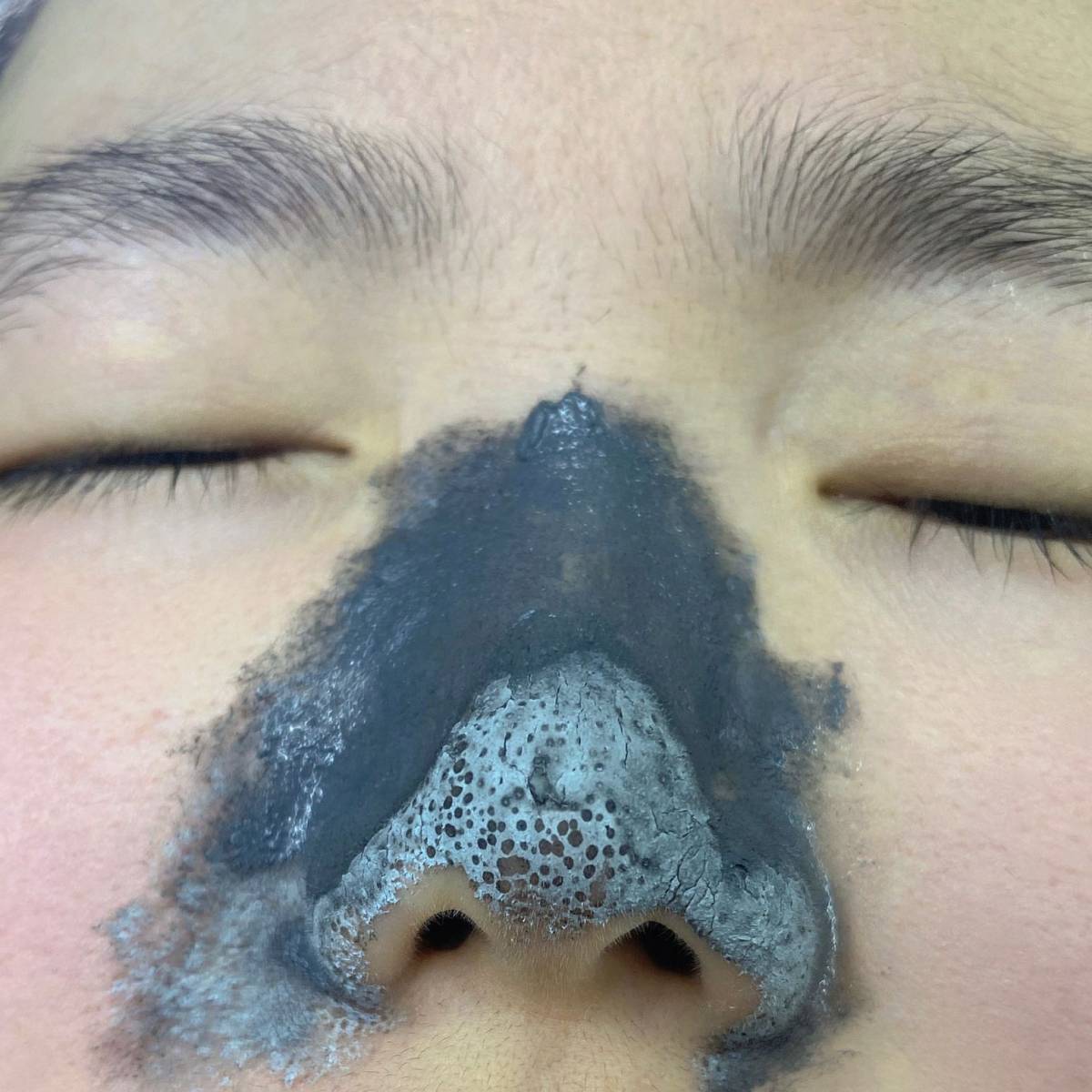 🌟本人混干皮，脸颊部分还是属于角质层比较薄的那种，平时运动