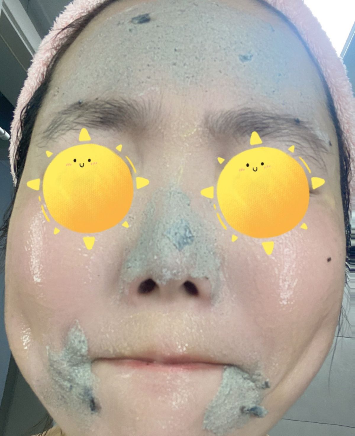 🌟本人混干皮，脸颊部分角质层比较薄，所以只针对T区和肤色暗