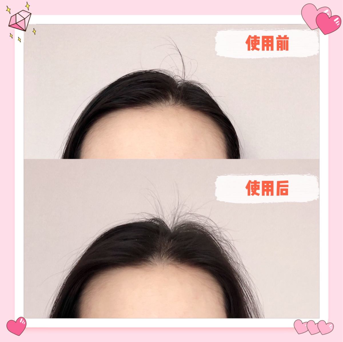 ⭐️细软油塌发夏日必备⭐️ ‼️油头福音‼️  ⭐️我的发质